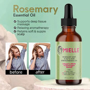Miss&Glow™ - Pack Routine (x3) Huile Romarin pour la pousse des cheveux